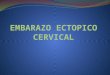 Embarazo Ectopico Cervical 1