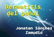 Dermatitis del pañal Jonatan Sánchez Zamudio. DEFINICION Se entiende por dermatitis del pañal, en sentido amplio, cualquier enfermedad cutánea que se