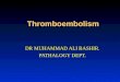 Thromboembolism,pulmonary embolism,general pathology