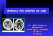 DEMENCIA POR CUERPOS DE LEWY Dr. Alex Espinoza Giacomozzi. Neurología, hospital DIPRECA. Dr Chaná