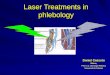 Laser Treatments in phlebology Daniel Cassuto Milano, Prof. a C. Chirurgia Plastica Università di Catania