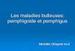 Les maladies bulleuses: pemphigoide et pemphigus Michèle Ohayon m.d
