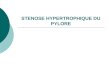 STENOSE HYPERTROPHIQUE DU PYLORE. Historique Premier cas décrit en 1888 Premier traitement chirurgical en 1907 Définition Hypertrophie des couches musculaires