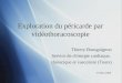 Exploration du péricarde par vidéothoracoscopie Thierry Bourguignon Service de chirurgie cardiaque, thoracique et vasculaire (Tours) 15 Mars 2008 Thierry