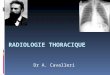 RADIOLOGIE THORACIQUE Dr A. Cavalleri. Plusieurs possibilités sont offertes pour explorer radiologiquement le thorax le cliché de face et de profil la