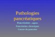 Pathologies pancréatiques Pancréatites aigües Pancréatites chroniques Cancer du pancréas