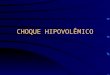 CHOQUE HIPOVOLÊMICO. Choque hipovolêmico: Classificação Hemorrágico Não-hemorrágico – Perdas externas – Redistribuição intersticial