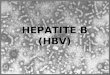 HEPATITE B (HBV). Existência de uma forma de hepatite transmitida por via parenteral (1885) Surtos atribuídos ao uso de vacinas preparadas com soro convalescente