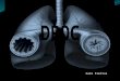 Sara Freitas. Definição de DPOC Doença prevenível e tratável com alguns efeitos extra- pulmonares significativos que podem contribuir para a gravidade