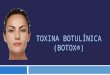 TOXINA BOTULÍNICA (BOTOX®). O que é toxina botulínica tipo A? É uma substância de origem biológica obtida a partir da cultura da bactéria Clostridium