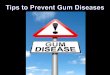 Tips to Prevent Gum Diseases