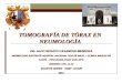 Tomografía tórax en Neumología casanova 2014