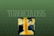 Pae  Tuberculosis