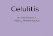 Celulitis  i