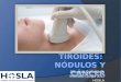 Cirugía: Nodulos y Cáncer de Tiroides
