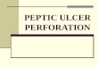 Peptic Ulcer Perforate
