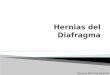 Hernias Del Diafragma