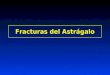 05- Fracturas Del Astragalo
