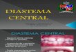 Diastema Central Definitivo 2