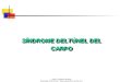Presentación Sindrome Tunel Carpiano.ppt