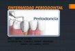 Enfermedad periodontal, PERIODONTITIS CRONICA, PERIODONTITIS AGRESIVA