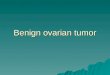 Benign Ovarian Tumor
