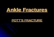 6. ankle fractures