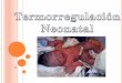Termoregulación del neonato e incubadora