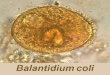 Balantidium colli