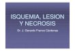 Isquemia, Lesion Y Necrosis