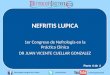 Nefritis Lupica - Conferencia del Dr. Juan Vicente Cuéllar Gonzalez (parte 4 de 4)