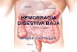 Hemorragia digestiva baja (2)