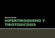 Hipertiroidismo y tirotoxicosis, caso clinico