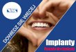 Implanty: Pytania do dentysty