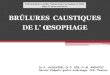 Brulures caustiques oesophage