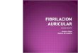 Fibrilacion auricular[2]