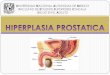 Hiperplasia Prostatica