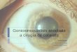 Tratamiento quirúrgico del cierre angular agudo primario (glaucoma agudo)