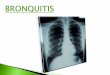bronquitis y cuidados de enfermeria