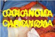 Hepatocarcinoma enarm 2013