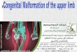 العيوب الخلقيه في اليدين عند الاطفال  - Congenital malformation of the upper limb- - البروفيسور فريح ابوحسان