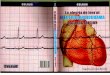 La alegria de_leer_el_electrocardiogramas