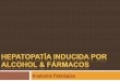 Hepatopatía inducida por alcohol & fármacos