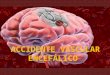 Accidente vascular encefálico