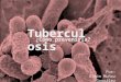 Tuberculosis ¿Cómo prevenirla?