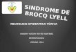 Sindrome de Brock-Lyell