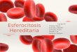 Esferocitosis hereditariafinal (1)