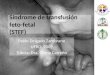 Síndrome de transfusión feto fetal
