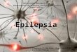 Epilepsia power