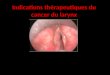 Cancer du larynx indications thérapeutiques
